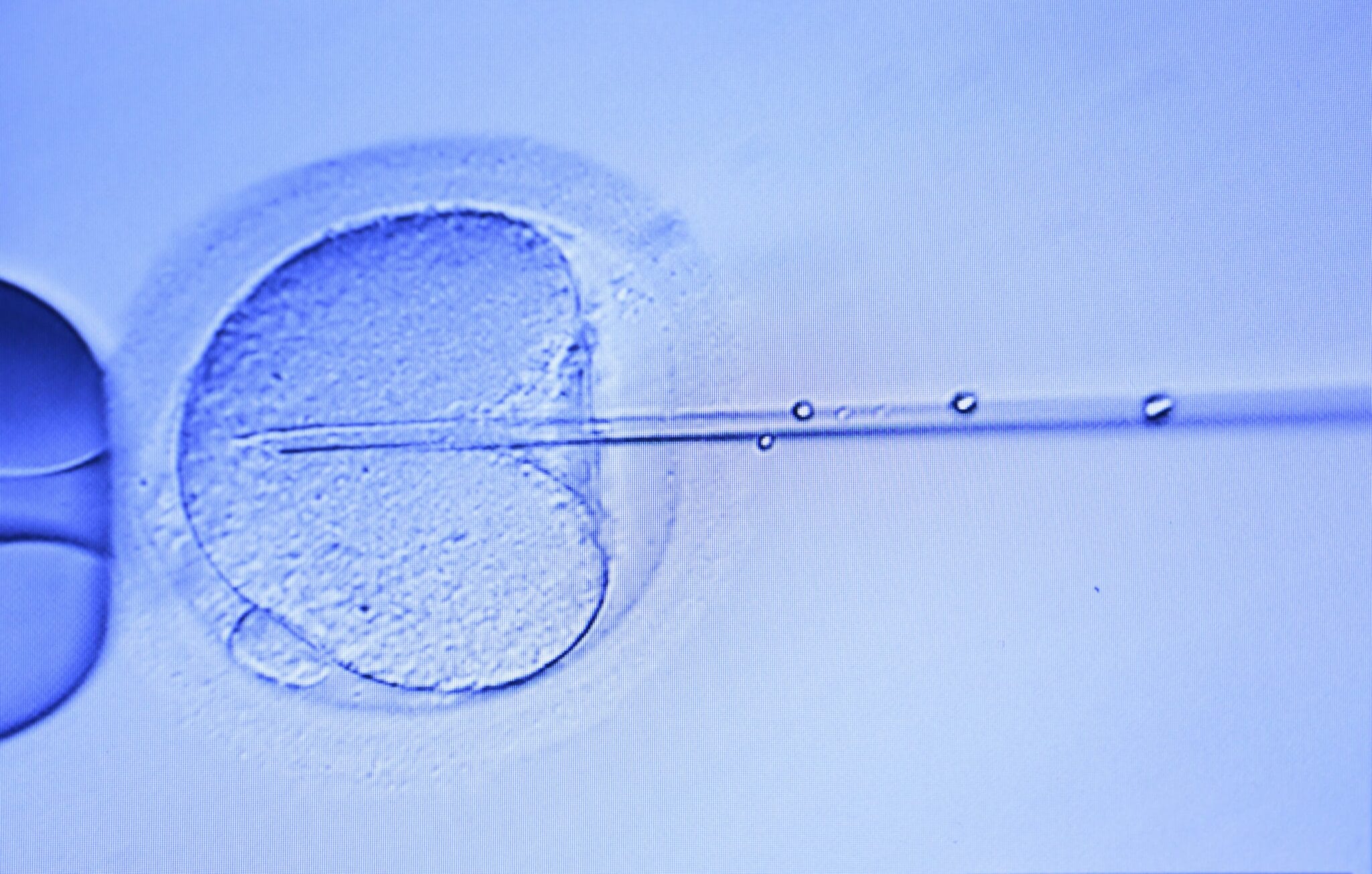 Icsi Lab Intracytoplasmic Sperm Injection (ICSI) | Egg Fertilization Doctors ...