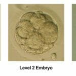 Cleavage Stage Embryo Grading